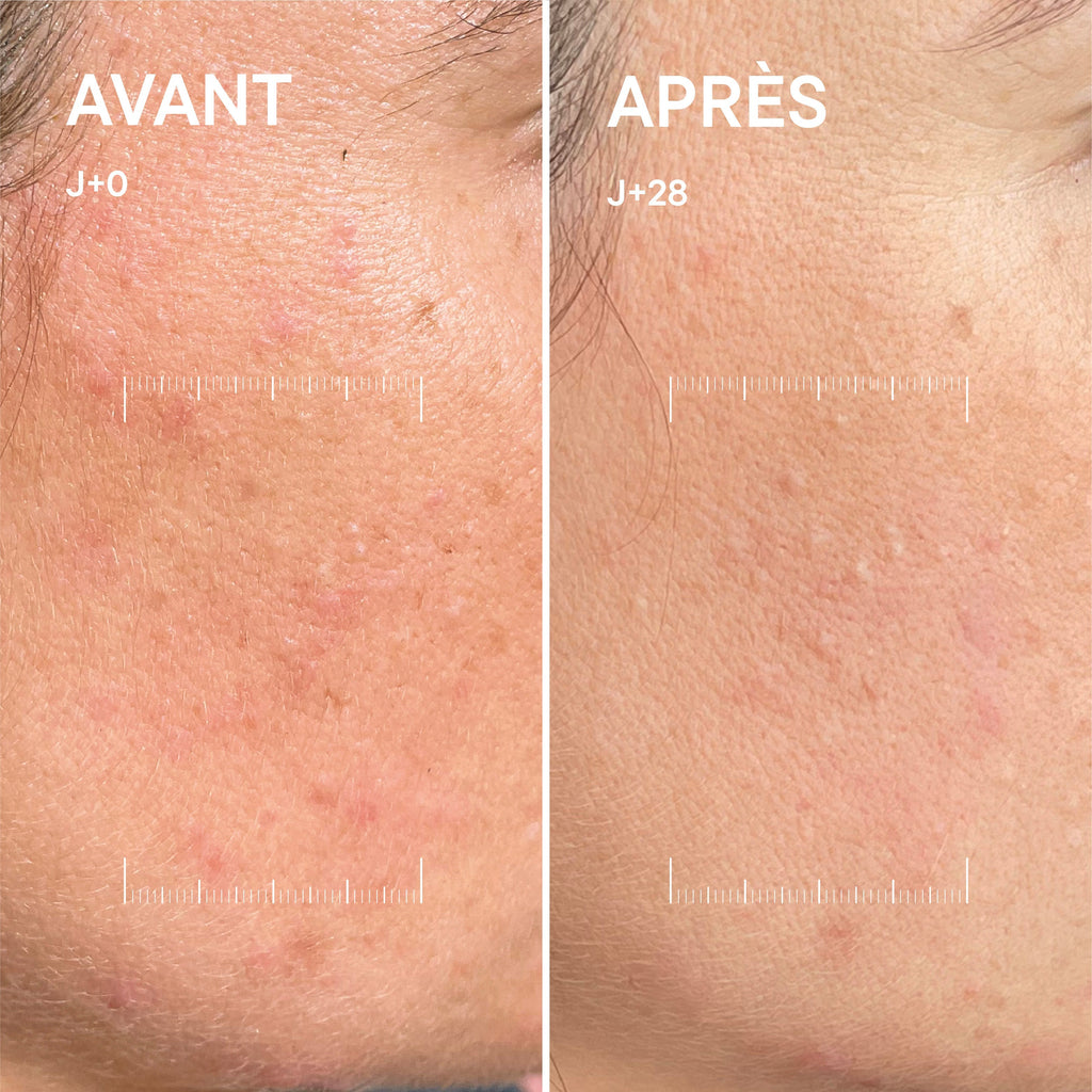 Sérum C-Activ+
