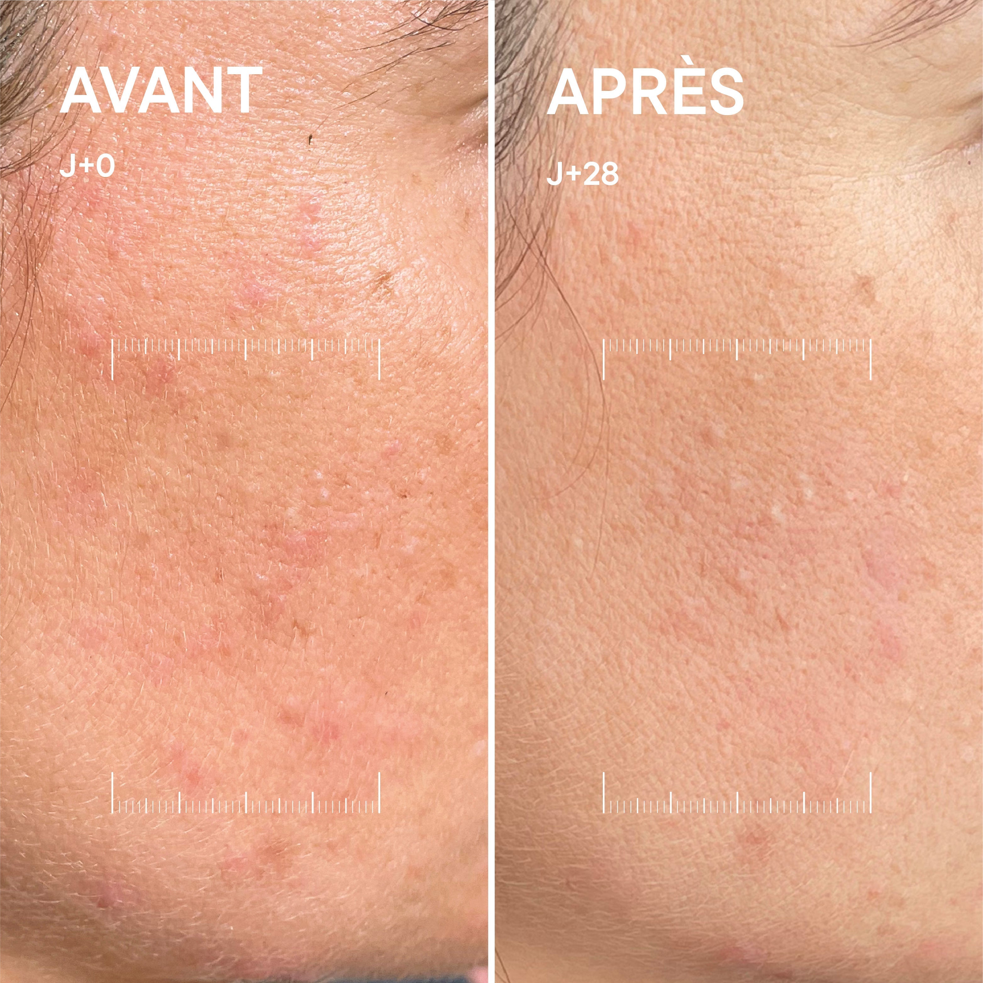 Sérum C-Activ+