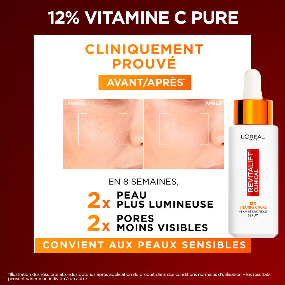 L'Oréal Paris - Coffret Cadeau - Sérum Vitamine C, Mascara Telescopic Lift, Rouge À Lèvres Liquide Mat
