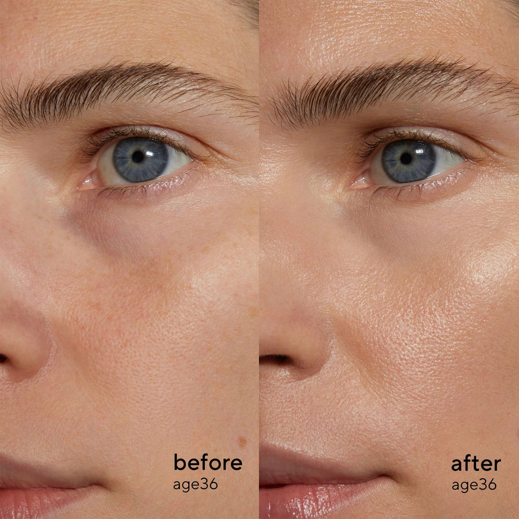 Retinol Alternative Sérum À Base De Plantes