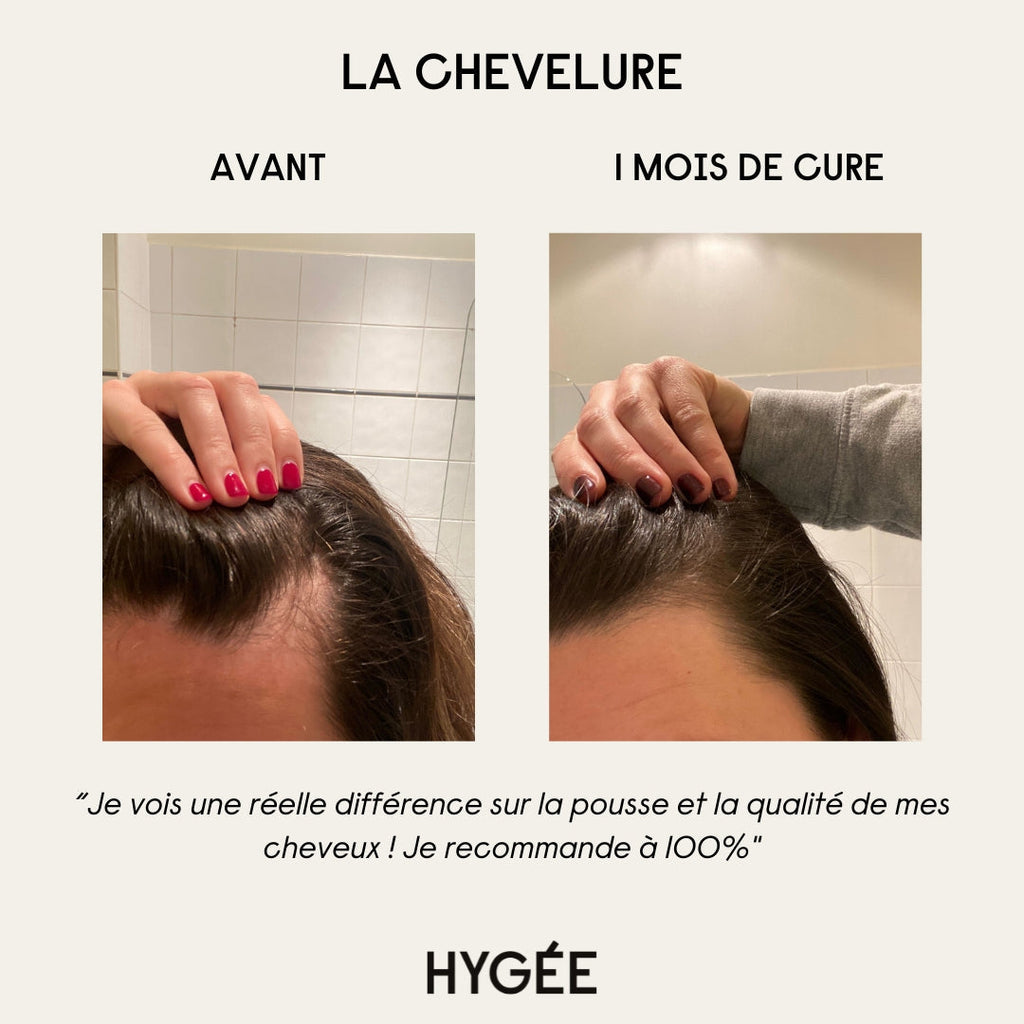Cure La Chevelure