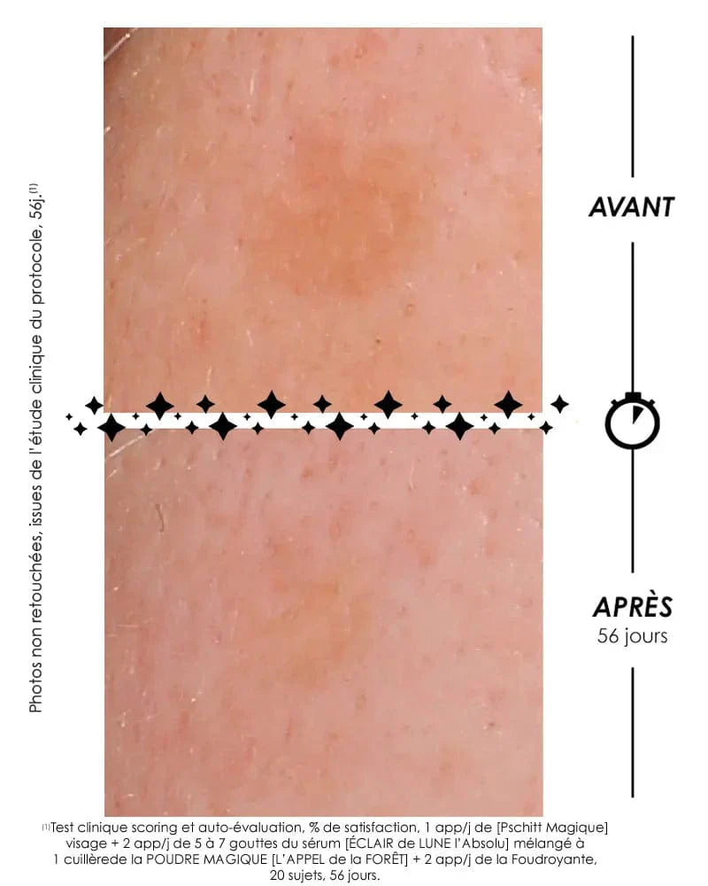 Laboratoire Garancia Crème de jour [ ÉCLAIR DE LUNE La Foudroyante ] Comparaison avant/après 56 jours sur l'atténuation d'une tache brune avec le protocole Garancia.
