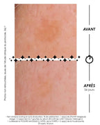 Laboratoire Garancia Crème de jour [ ÉCLAIR DE LUNE La Foudroyante ] Comparaison avant/après 56 jours sur l'atténuation d'une tache brune avec le protocole Garancia.