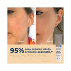 Soin qui répare la peau dès la 1ère application 