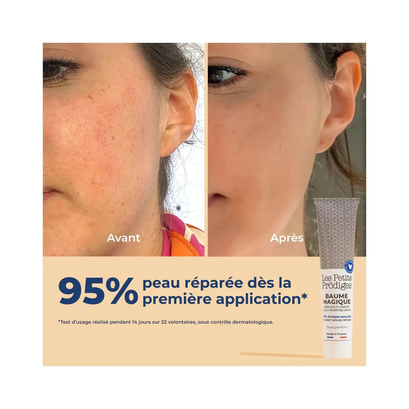 Soin qui répare la peau dès la 1ère application 