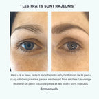 Absolu Hyaluronique