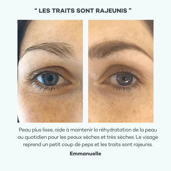 Absolu Hyaluronique