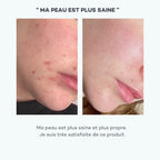 Absolu De Zinc