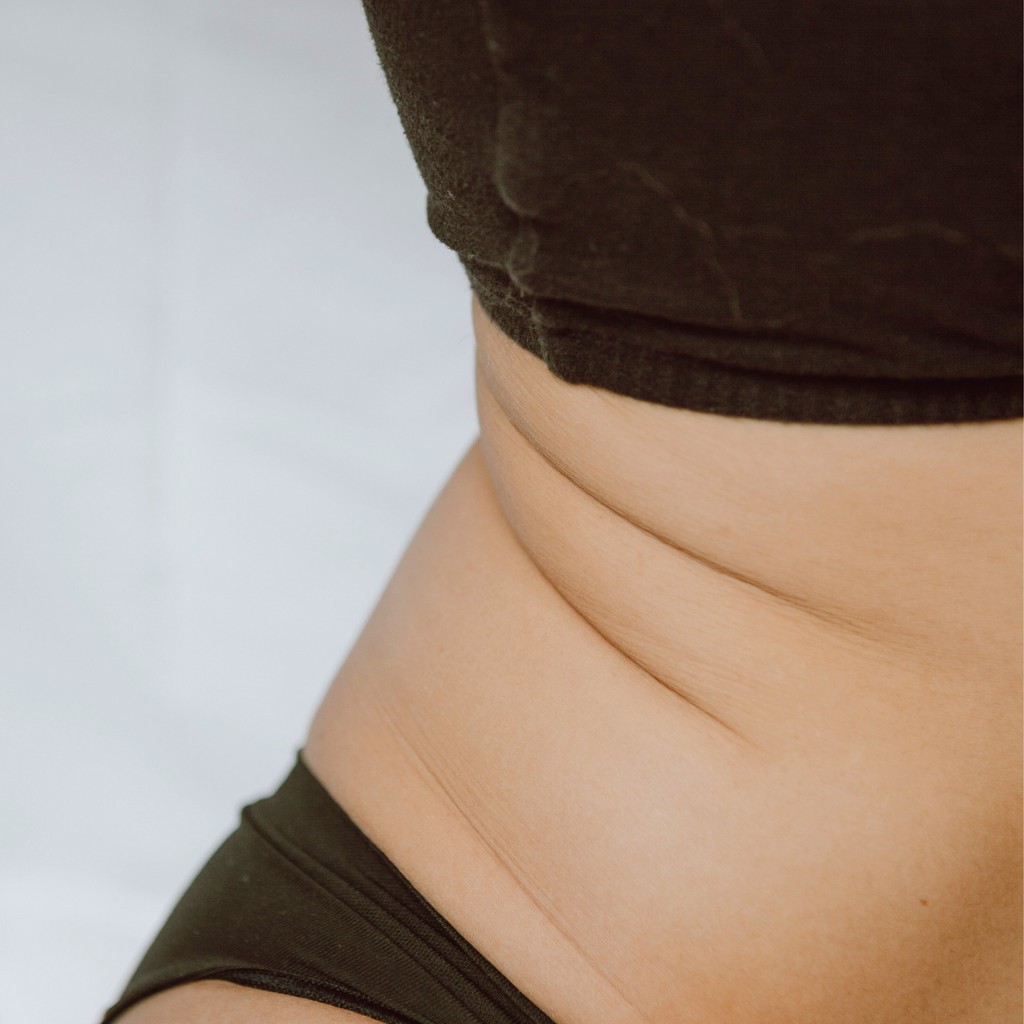 Cryolipolyse & 15Mns De Massage Palpé Roulé & Consultation Silhouette - 1 Zone Au Choix