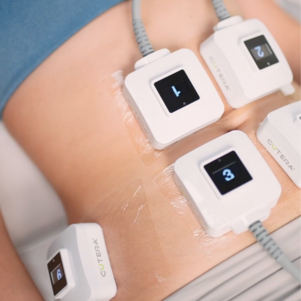 Graisse Localisée - Trusculpt Séance Découverte - 2 Pads - Petites Zones Au Choix