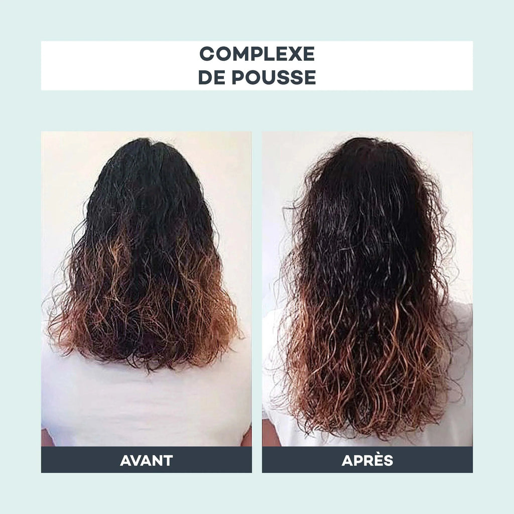 Complexe De Pousse - D-Lab - The Bradery