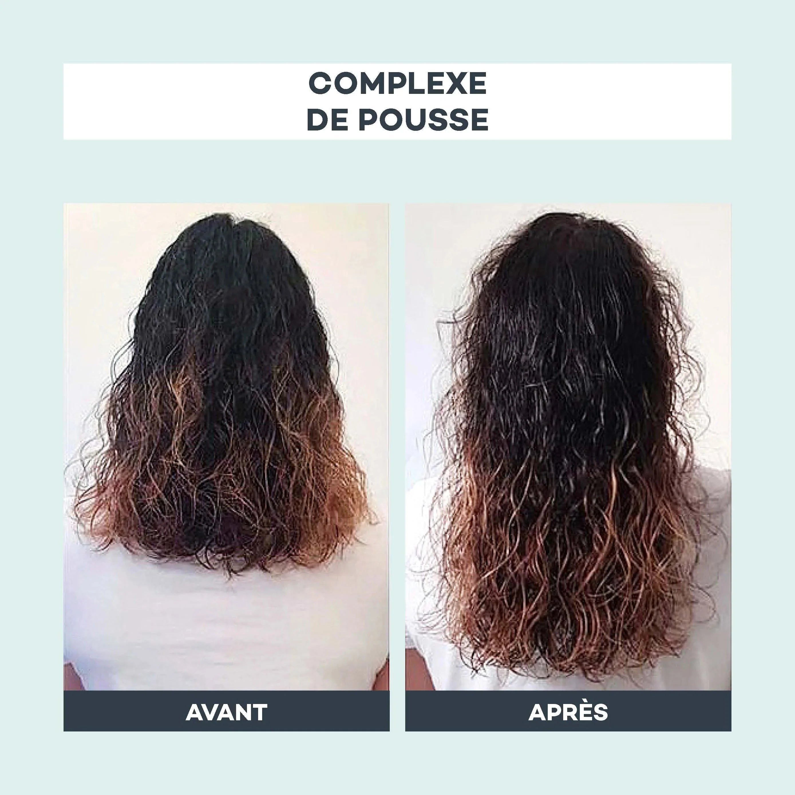 Complexe De Pousse - D-Lab - The Bradery