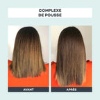 Complexe De Pousse - D-Lab - The Bradery
