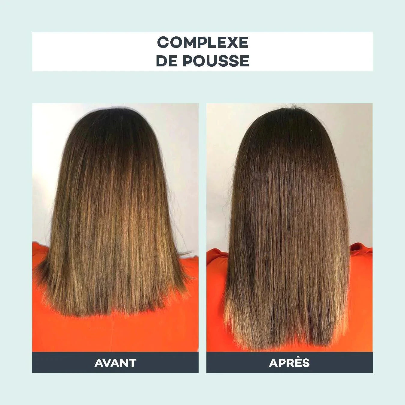 Complexe De Pousse - D-Lab - The Bradery