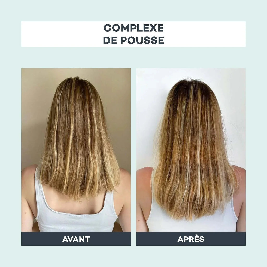 Complexe De Pousse - D-Lab - The Bradery
