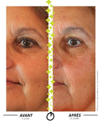 Laboratoire Garancia Anti-Âge & Anti-Rides [ ÉTOILE Polaire ] - visage avant apres application du serum