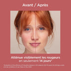 Redness Spf50+ Cr Solaire - 50Ml