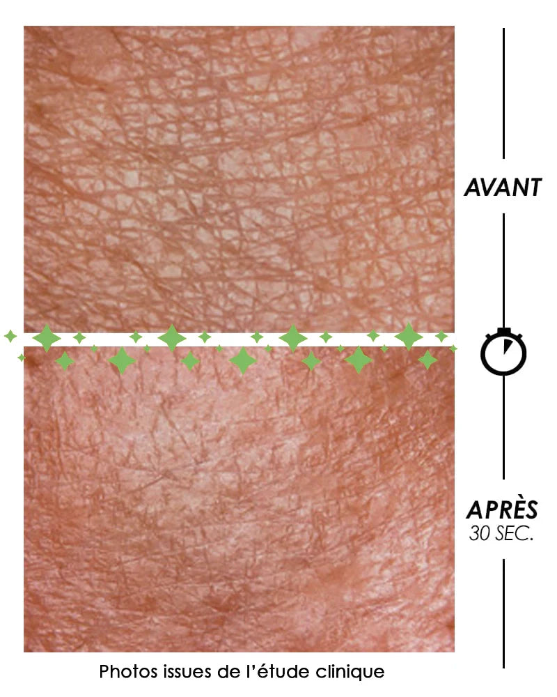 Gros plan macro d'une étude clinique Garancia montrant le grain de peau avant et après 30 secondes d'utilisation du Pschitt Magique. Le relief cutané est visiblement lissé et les pores sont resserrés.